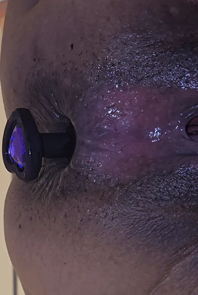 I ❤️ Anal